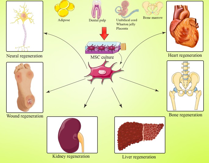 間充質干細胞(MSC) 是一種多能細胞,可分化為基質譜系細胞。間充質干細胞(MSC) 是骨髓 (BM-MSC)、脂肪組織、肝臟、羊水、胚胎胎盤、臍帶血和其他組織中的一組非造血細胞。骨髓間充質干細胞能夠抑制與GVHD病理生理學有關的大多數免疫細胞的激活和功能。 間充質干細胞(MSC) 是一種多能細胞,可分化為基質譜系細胞。間充質干細胞(MSC) 是骨髓 (BM-MSC)、脂肪組織、肝臟、羊水、胚胎胎盤、臍帶血和其他組織中的一組非造血細胞。骨髓間充質干細胞能夠抑制與GVHD病理生理學有關的大多數免疫細胞的激活和功能。