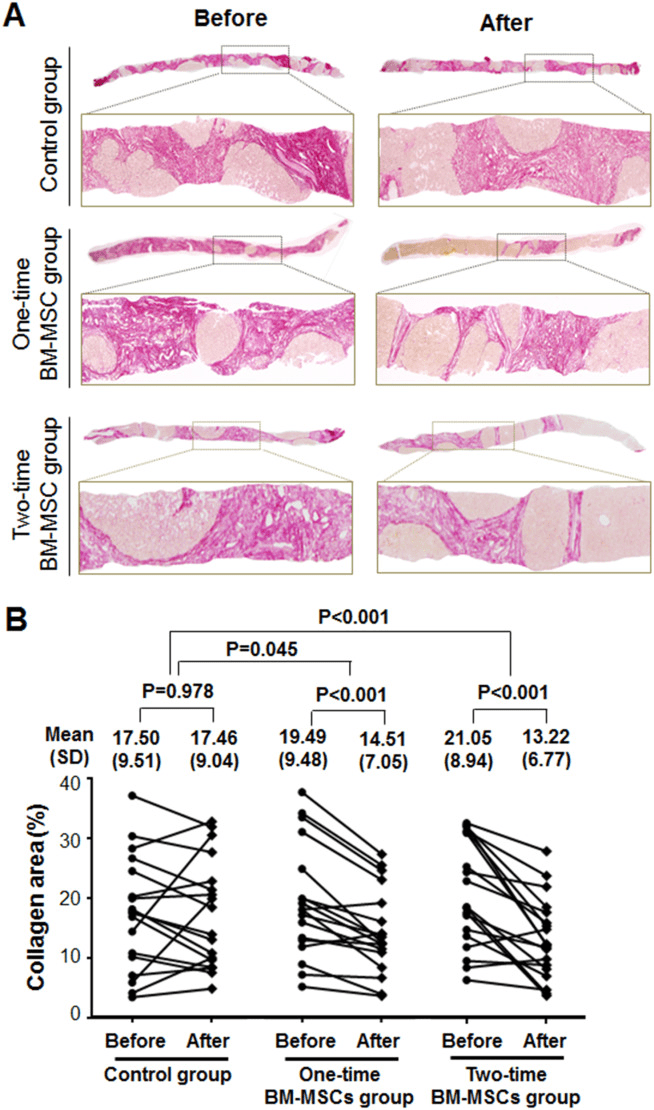 膠原蛋白面積的定量組織學分析。