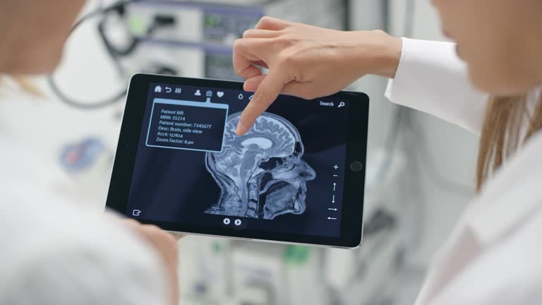 干細胞治療中風:2019至2024年的臨床研究進展 干細胞治療中風:2019至2024年的臨床研究進展