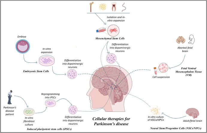 圖1:帕金森病的細胞療法:胚胎干細胞 (ESC)、誘導性多能干細胞 (iPSC)、間充質干細胞 (MSC)、神經干細胞/祖細胞 (NSC/NPS) 是帕金森病的新興候選藥物。 圖1:帕金森病的細胞療法:胚胎干細胞 (ESC)、誘導性多能干細胞 (iPSC)、間充質干細胞 (MSC)、神經干細胞/祖細胞 (NSC/NPS) 是帕金森病的新興候選藥物。