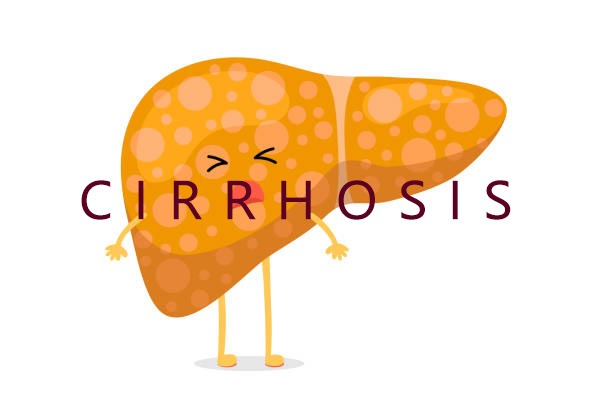 2020-2024年干細(xì)胞治療肝硬化的臨床研究進(jìn)展