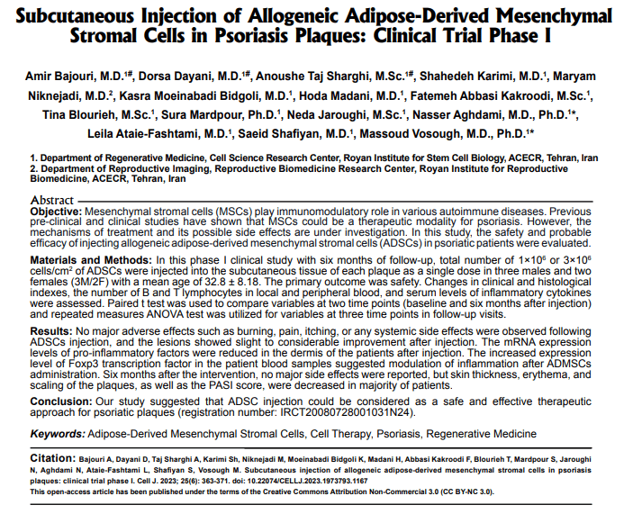 皮下注射異基因脂肪來源間充質干細胞治療銀屑病斑塊:第一期臨床試驗