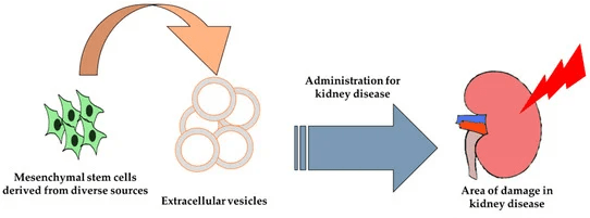 干細胞治療腎病