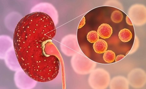 干細(xì)胞治療狼瘡性腎炎的安全性怎么樣？盤點(diǎn)國內(nèi)外臨床進(jìn)展！