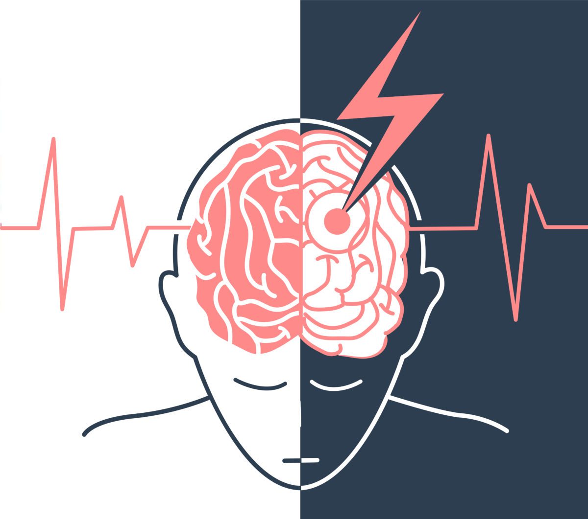 宣武醫院發布：間充質干細胞治療中風，可以改善患者神經功能障礙