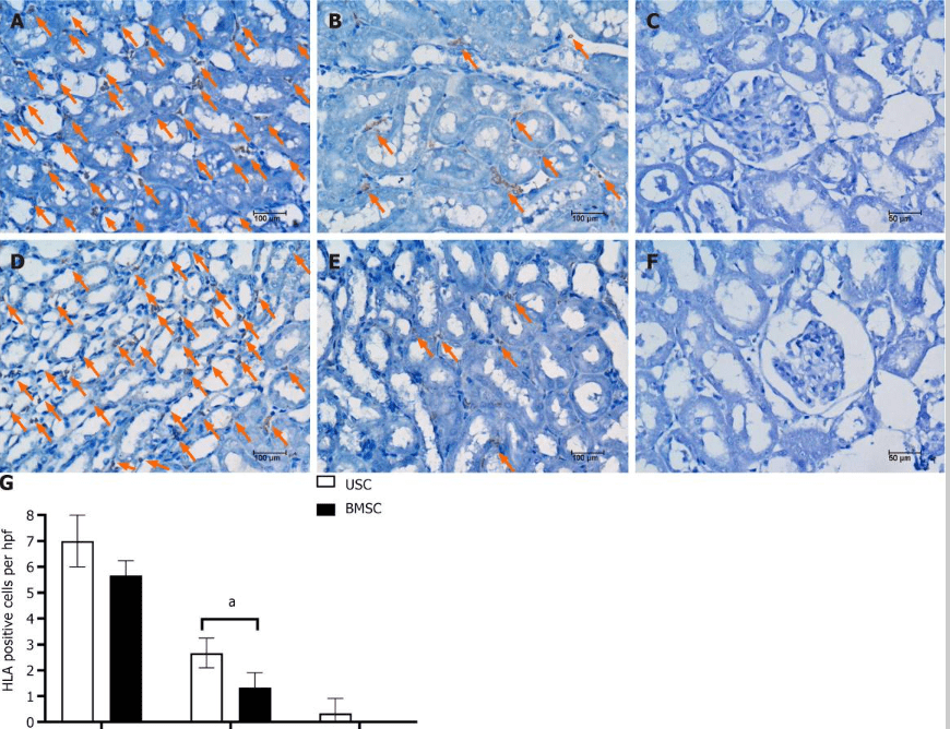 圖5：通過人類白細(xì)胞抗原免疫染色檢測(cè)急性腎損傷小鼠腎臟內(nèi)的尿液干細(xì)胞或骨髓間充質(zhì)干細(xì)胞