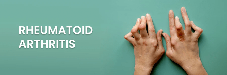 2024年最新進展報告：干細胞療法為類風濕關節炎帶來希望之光