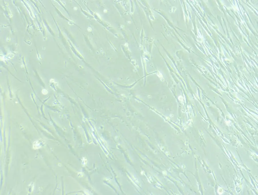 顯微鏡下的神經(jīng)干細胞。