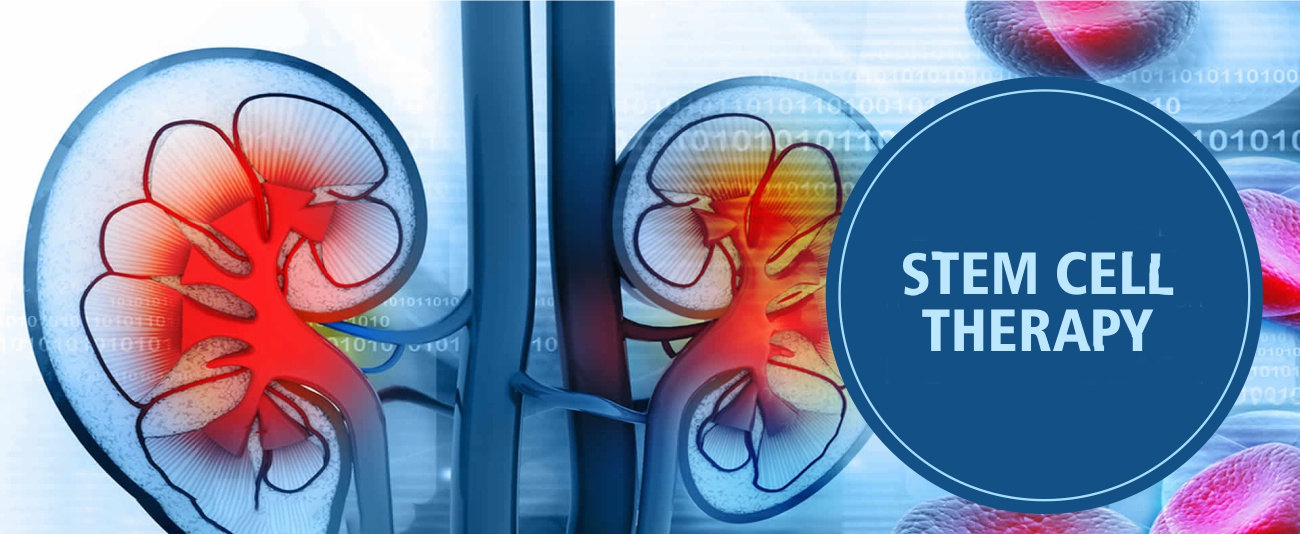 干細(xì)胞治療腎臟疾病的6大原理機(jī)制，您都了解嗎？