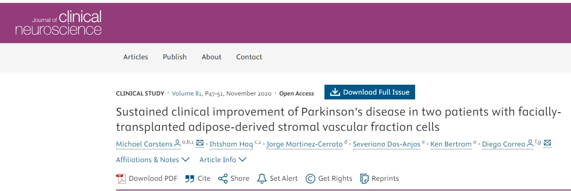 面部移植間充質干細胞治療2例帕金森病患者,患者臨床癥狀持續改善 面部移植間充質干細胞治療2例帕金森病患者,患者臨床癥狀持續改善