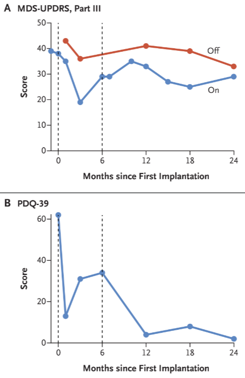 MDS-UPDRS表和生活質量評分 MDS-UPDRS表和生活質量評分
