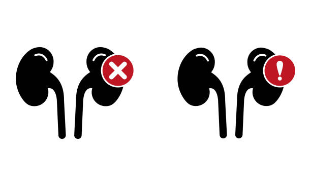 探索干細(xì)胞療法：能否成為降低腎病患者肌酐水平的新希望？