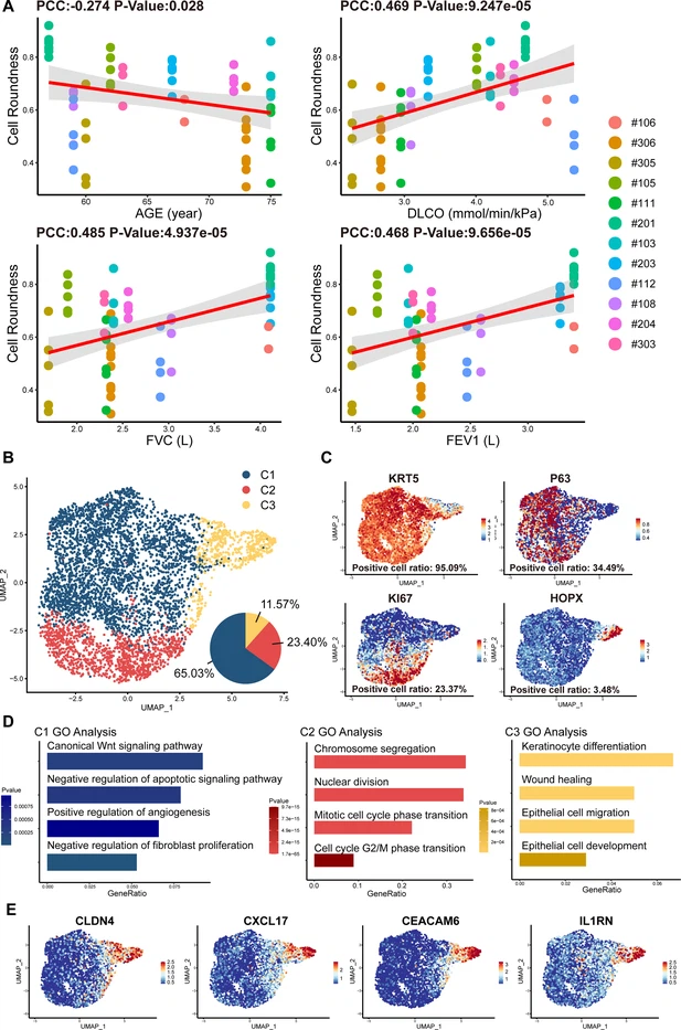 圖2：從IPF患者中分離的P63+肺祖細胞的細胞形態和單細胞RNA測序分析。