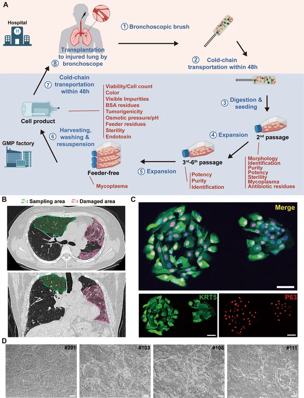 圖1：從IPF患者中分離的P63+肺祖細胞的克隆和表征。