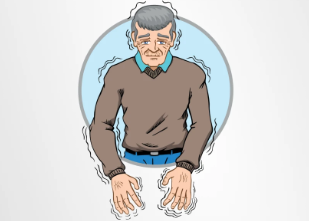 從短期緩解到長期穩(wěn)定：干細胞移植治療帕金森病的療效持續(xù)時間研究