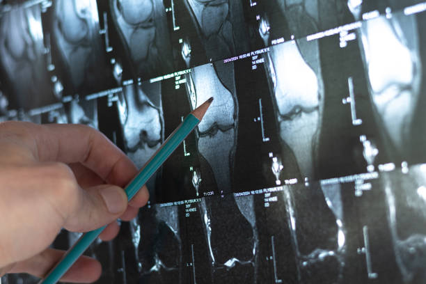 4種細胞療法運用免疫調節(jié)和再生機制為治療骨科疾病開辟了新方向