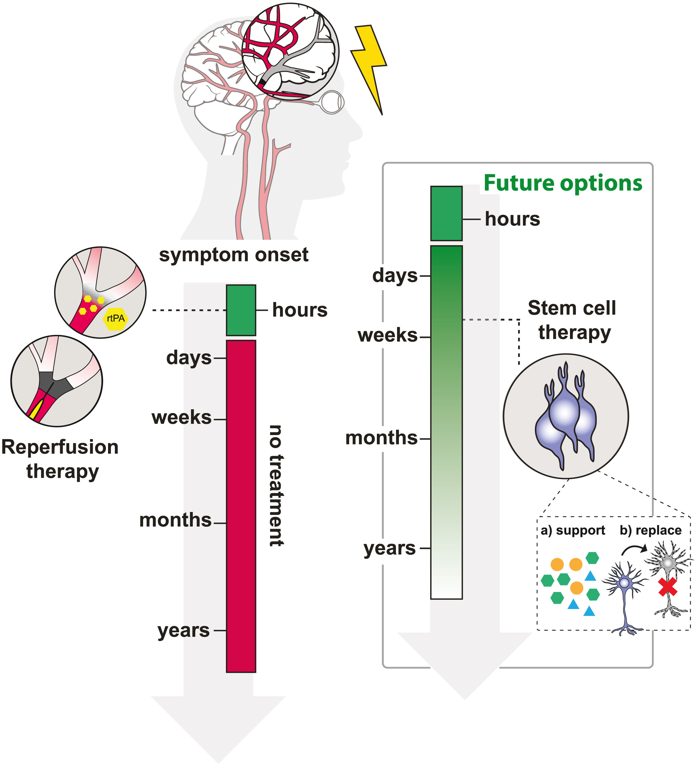 圖1：治療缺血性中風(fēng)的現(xiàn)有和未來選擇