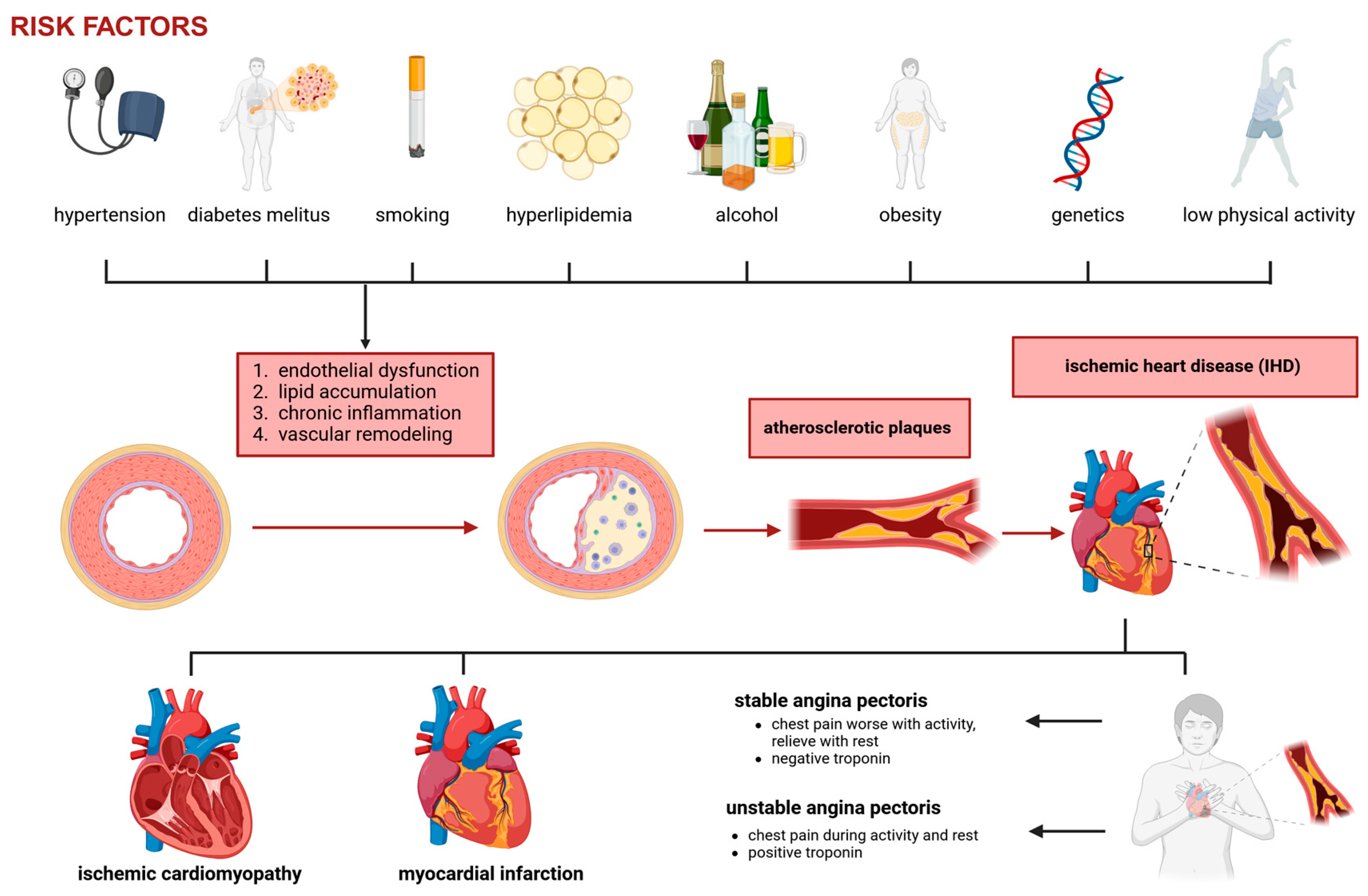 圖1：冠狀動(dòng)脈疾病和缺血性心臟病的病理生理學(xué)。