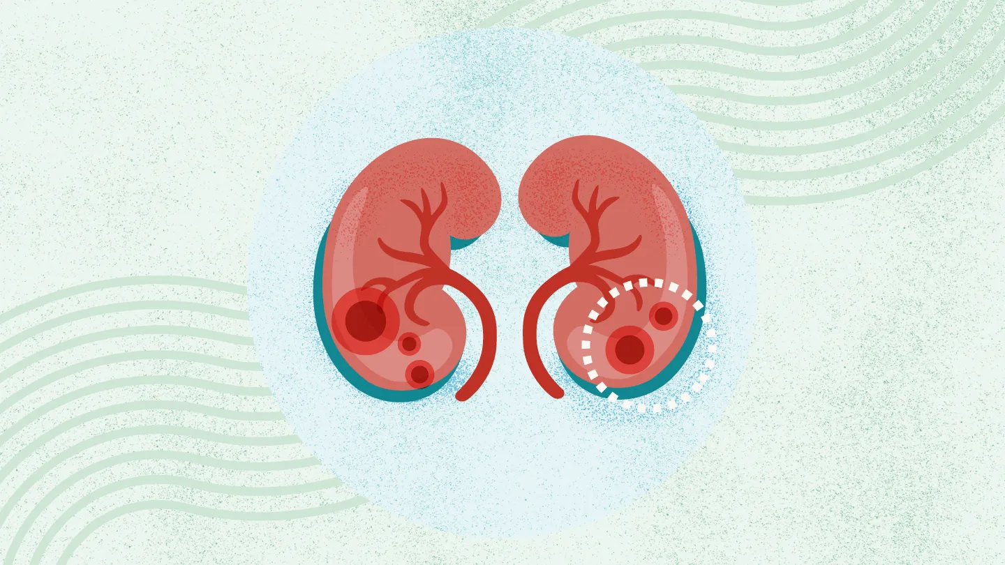 2025年國內干細胞治療腎病的醫院都有哪幾家？