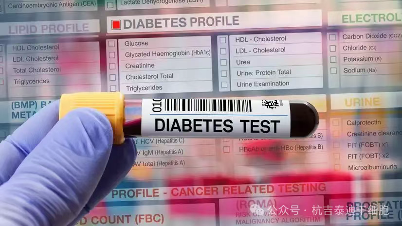 突破性干細(xì)胞療法Zimislecel：83%重癥糖尿病患者停用胰島素超一年