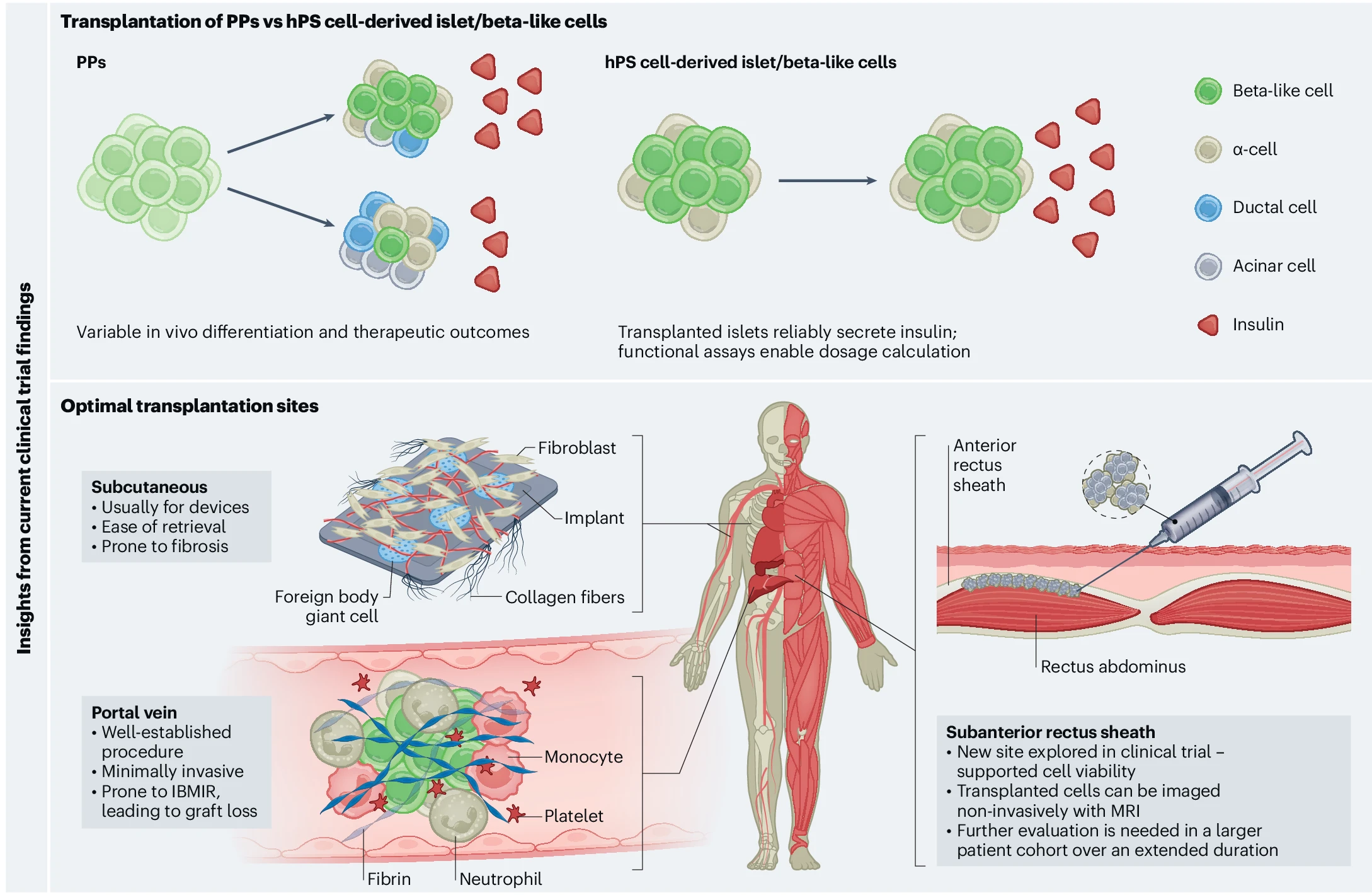 圖2：最新干細(xì)胞治療糖尿病的創(chuàng)新和經(jīng)驗教訓(xùn)