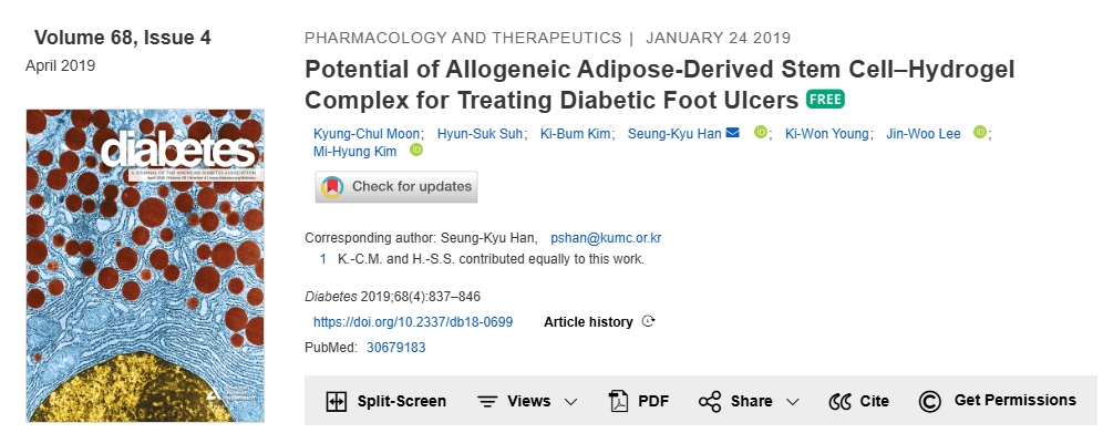 同種異體脂肪干細胞-水凝膠復合物治療糖尿病足潰瘍的潛力