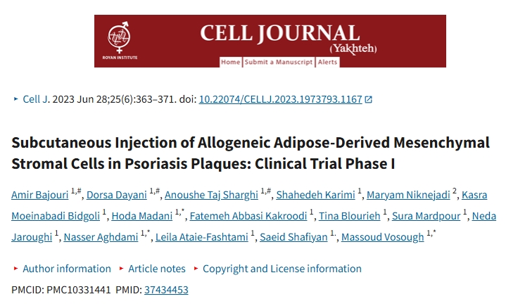 皮下注射同種異體脂肪間充質基質細胞治療銀屑病斑塊：I期臨床試驗