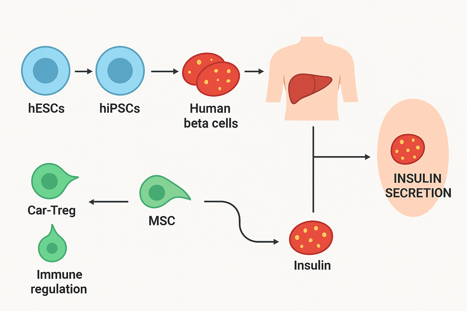 新研究有望終結胰島素注射!《糖尿病研究雜志》:干細胞療法可功能性治愈1型糖尿病 新研究有望終結胰島素注射!《糖尿病研究雜志》:干細胞療法可功能性治愈1型糖尿病
