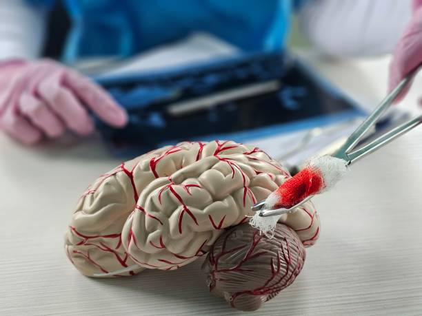 “開關(guān)現(xiàn)象”能解決？干細胞為帕金森病治療帶來新希望