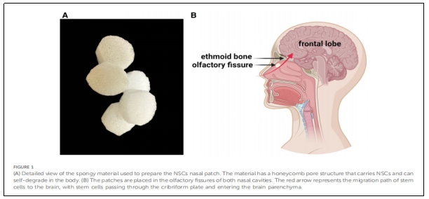 圖1：用于制備NSCs鼻貼片的海綿狀材料的詳細(xì)視圖。