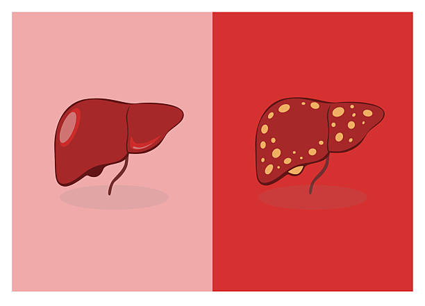 國內(nèi)外干細胞治療肝硬化進展對比：哪項技術(shù)更成熟、效果更好？