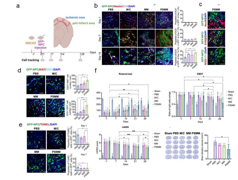 負(fù)載NPCs的PSMM-基質(zhì)復(fù)合支架促進(jìn)大鼠卒中后損傷修復(fù)
