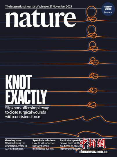 研究成果發(fā)表于國際頂級期刊《自然》并登上雜志封面。研究團(tuán)隊供圖 研究成果發(fā)表于國際頂級期刊《自然》并登上雜志封面。研究團(tuán)隊供圖