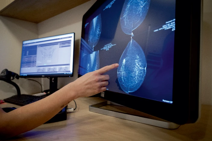 轉移性乳腺癌患者迫切需要新的治療方法。