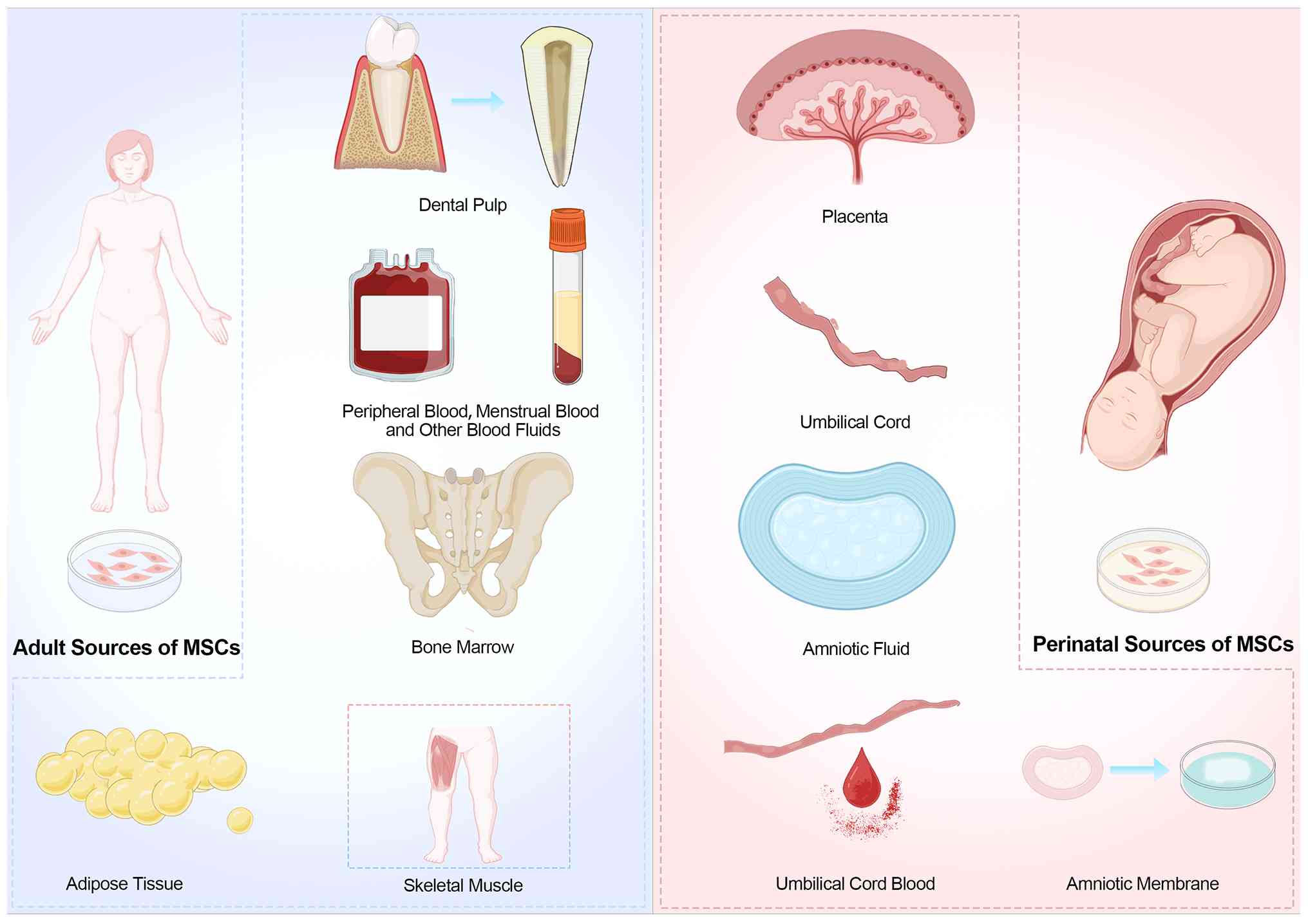 圖2：間充質干細胞的來源。成人間充質干細胞可來源于骨髓、脂肪組織、外周血、骨骼肌和牙髓。圍產(chǎn)期間充質干細胞通常取自胎盤、臍帶、臍帶血、羊水和羊膜。